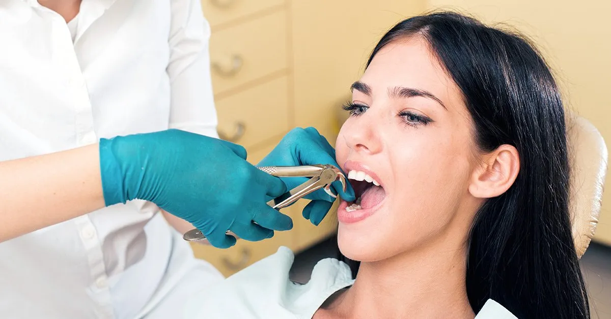 dental extraction