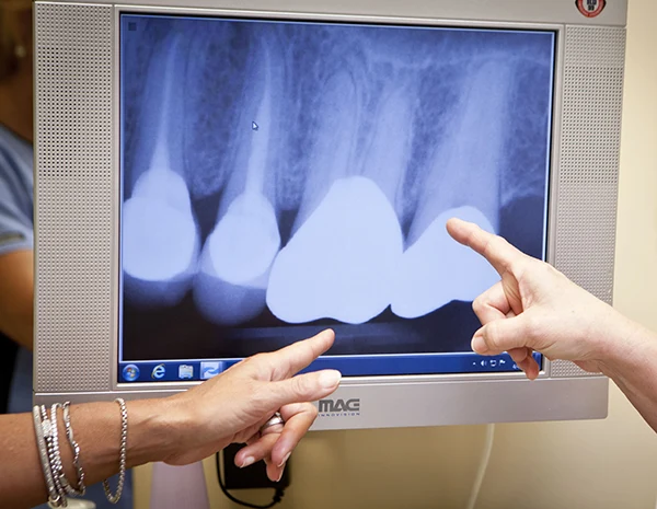 dental x rays